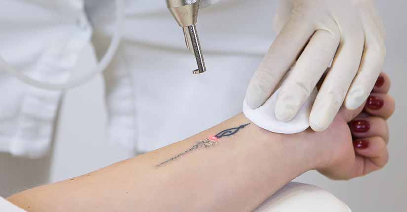What Are Nail Tattoos And Are They Safe?